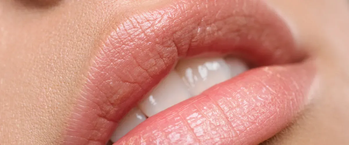 Kusslippen Nahaufnahme