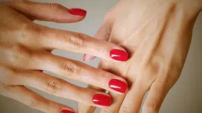 Handrückenverjüngung